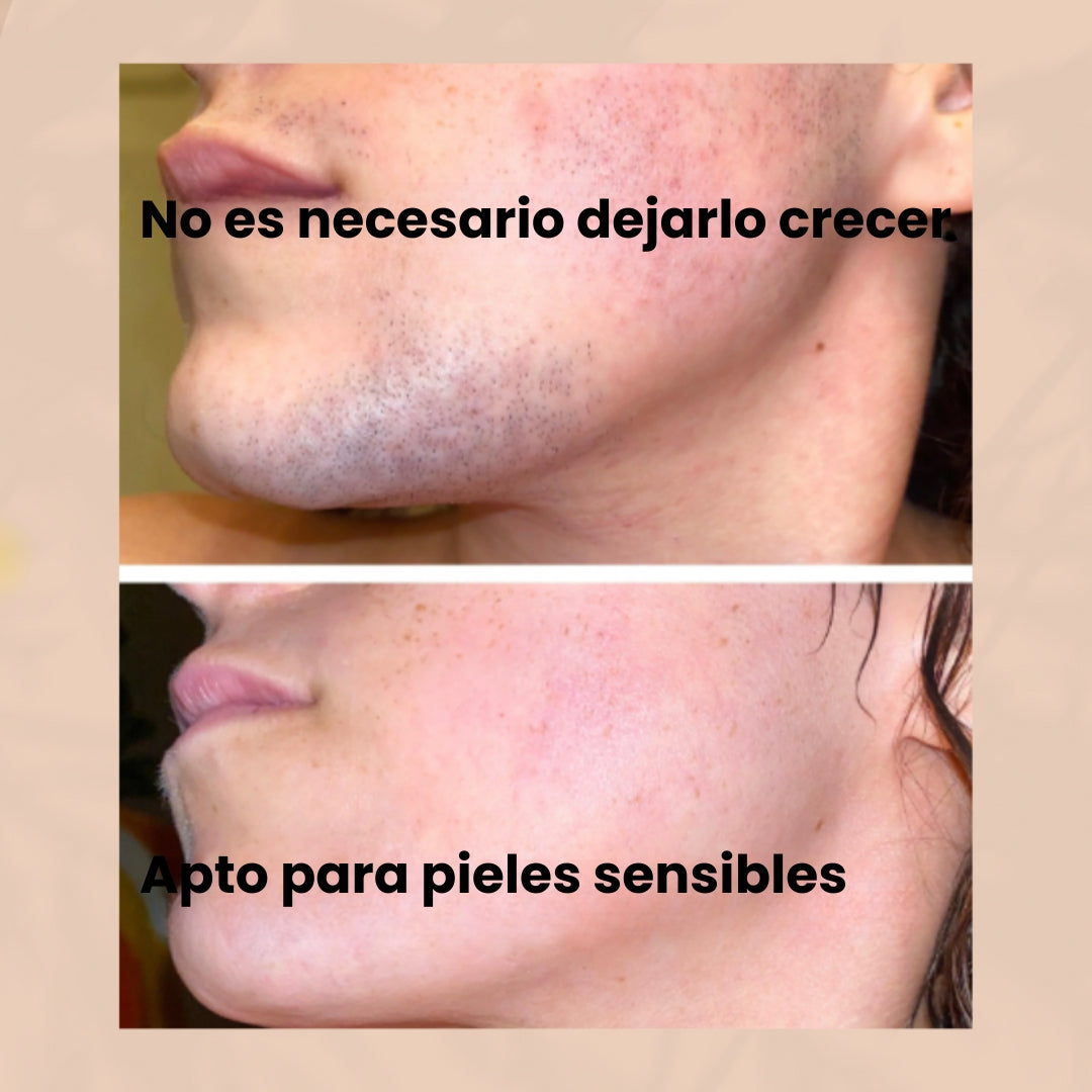 Kit de depilación