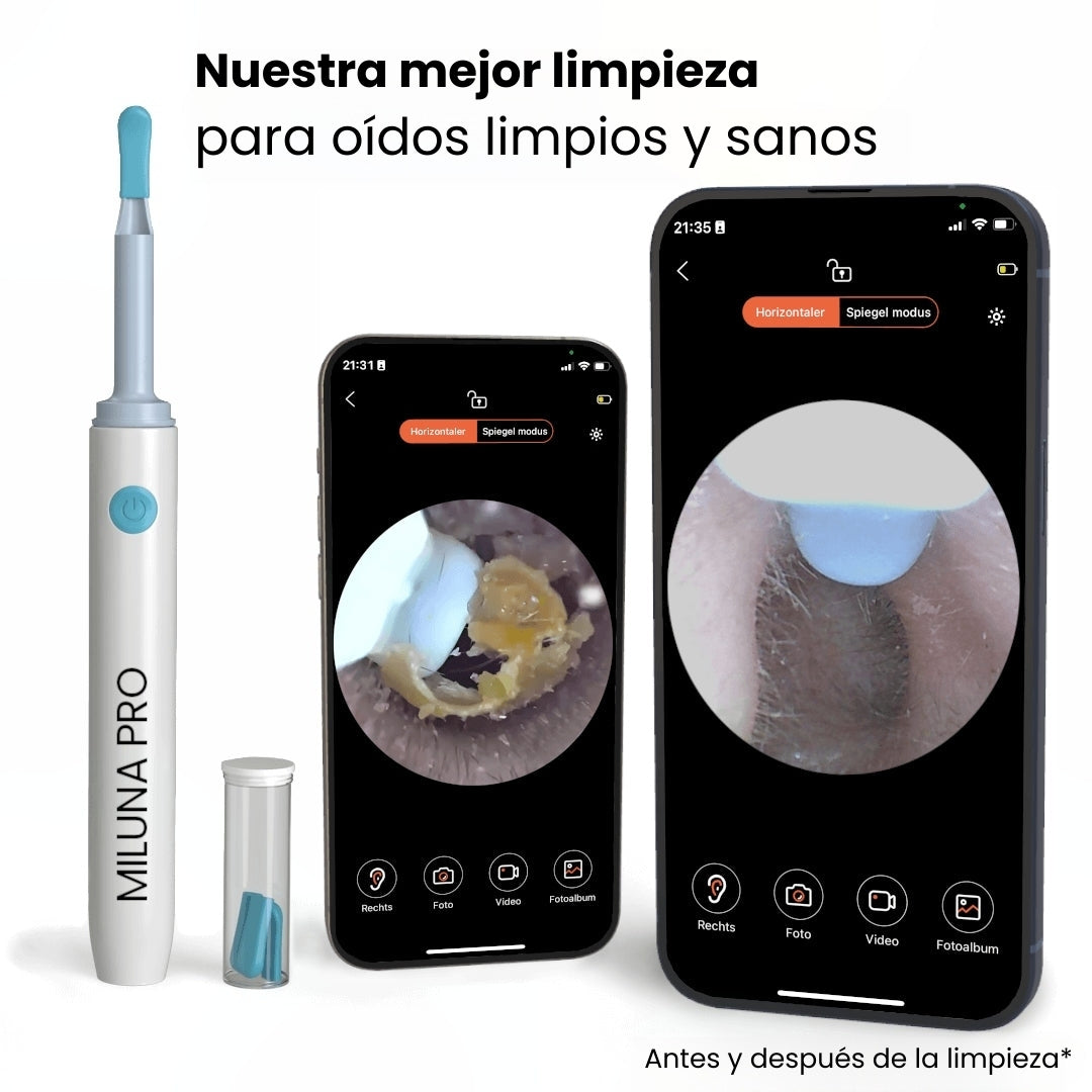 Limpiador de oídos inteligente con cámara HD