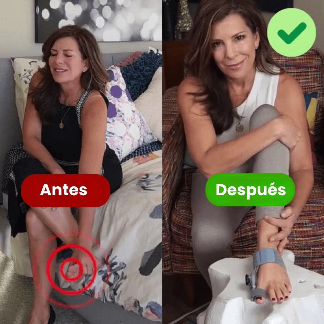 ToeComfort™: Ajuste suave y alivio del dolor del hallux valgus