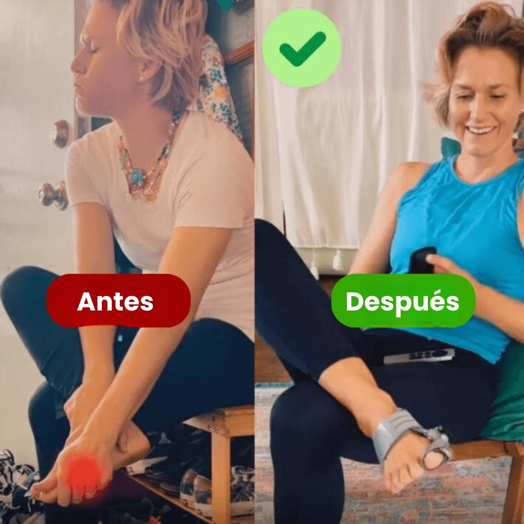 ToeComfort™: Ajuste suave y alivio del dolor del hallux valgus