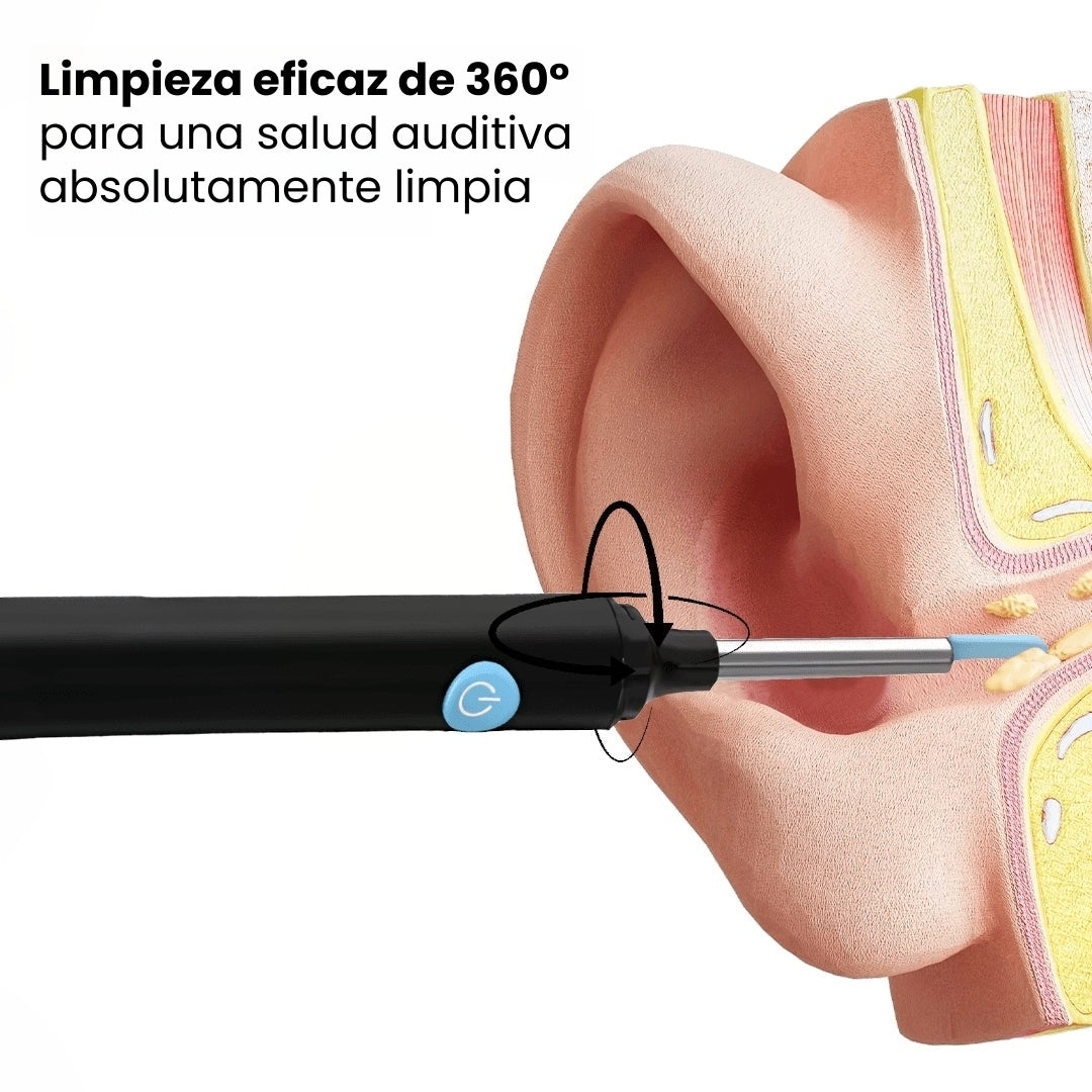 Limpiador de oídos inteligente con cámara HD