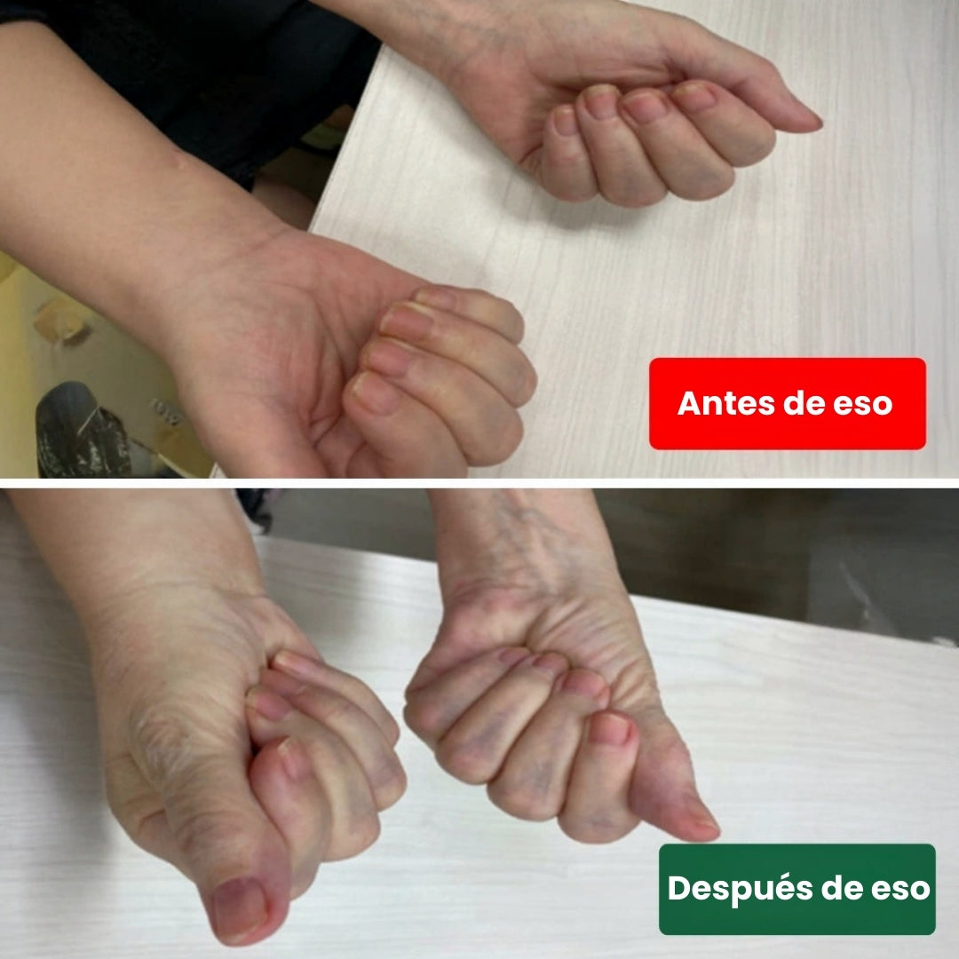 El soporte de muñeca 3 en 1 de Nervio