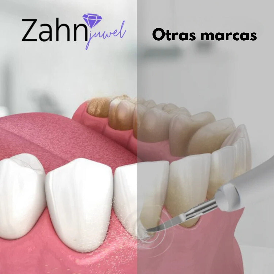 Limpiador dental ZahnJuwel™ Pro