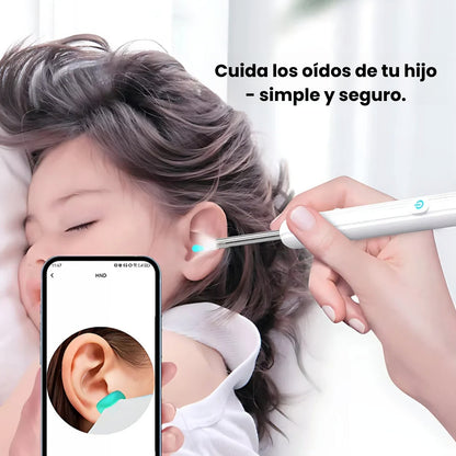 EarView™ – Limpieza inteligente de oídos con tecnología suave y avanzada