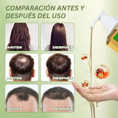 Champú con aceite de Gypsophila Batana y romero: champú nutritivo y voluminizador para hombres y mujeres. Limpia el cuero cabelludo, reduce la caída del cabello, repara el daño y favorece su crecimiento (300 ml/10,14 fl oz).