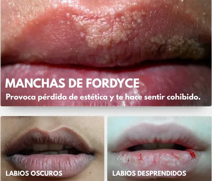 Crema para labios oscuros