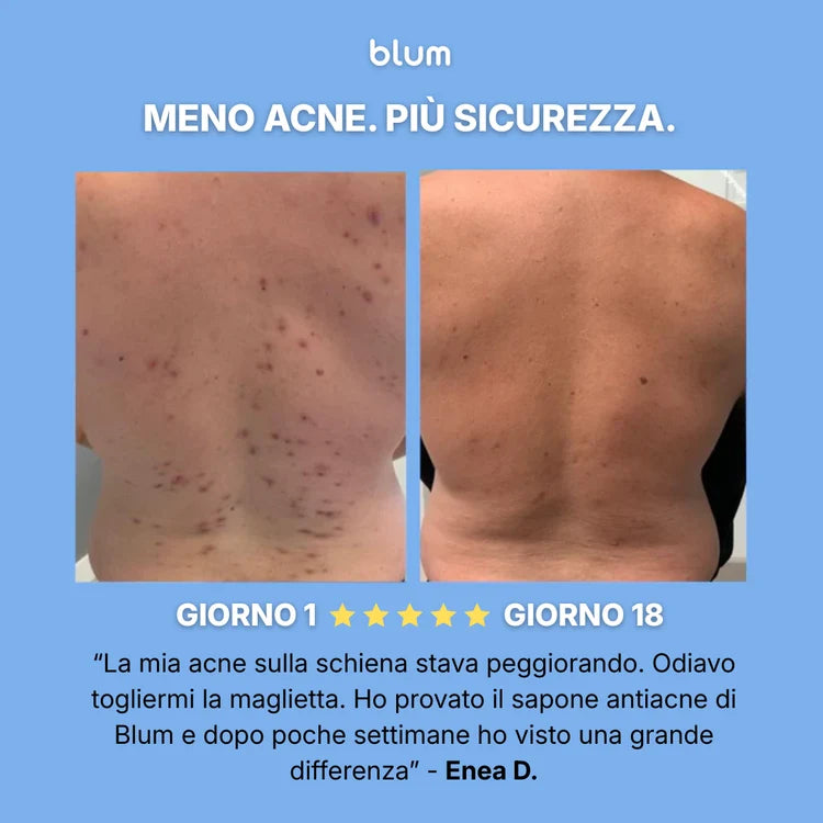 Jabón purificante antiacné