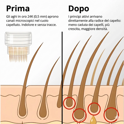 Sistema de crecimiento capilar Apex