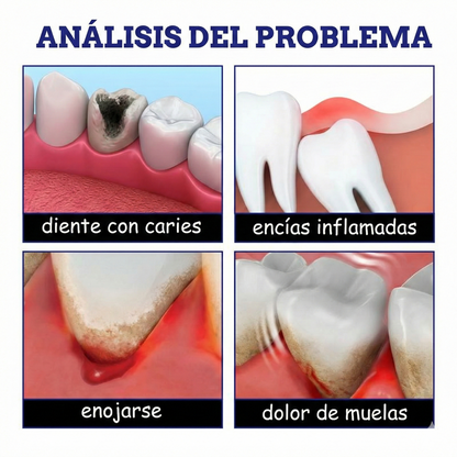 Spray para el cuidado bucal - Fórmula suave