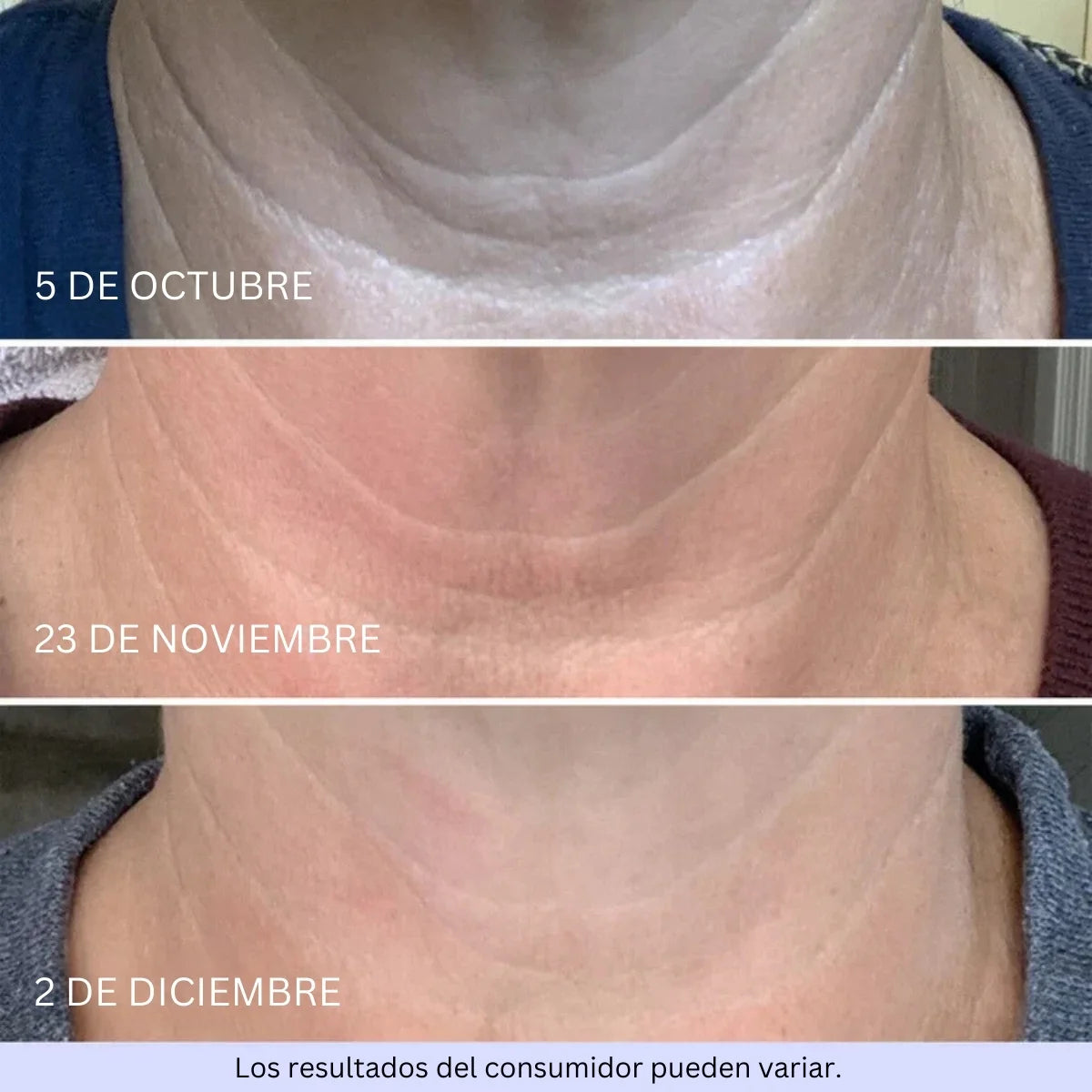 Crema para el cuello: crema reafirmante y tensora para el cuello para pieles arrugadas, 1,7 fl oz (50 ml)