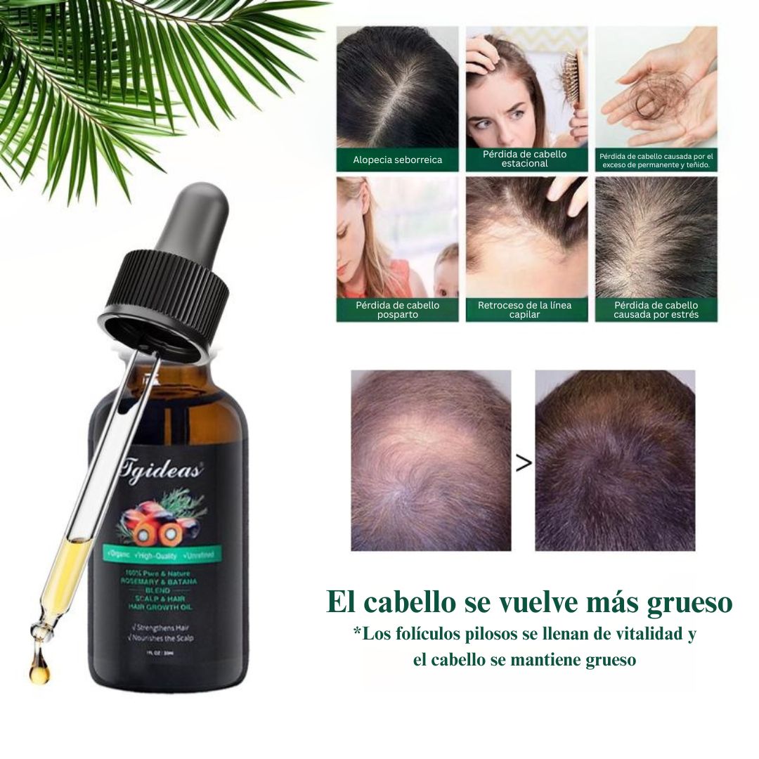 Aceite de romero y batana Tgideas - Mezclado con aceite de jojoba y argán - Aceite esencial 100% orgánico para el cuidado del cabello. Reparador diario, restaura la humedad y las vitaminas.