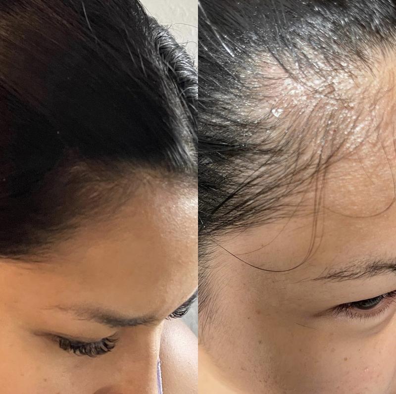 Aceite para el crecimiento del cabello - Ingredientes a base de plantas Cuidado del cabello Aceite de romero natural neutro Salud del cuero cabelludo Engrosamiento Nutrición