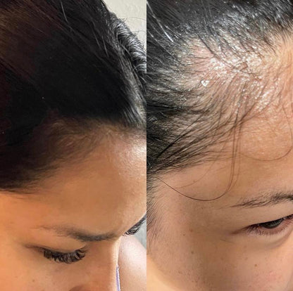 Aceite para el crecimiento del cabello - Ingredientes a base de plantas Cuidado del cabello Aceite de romero natural neutro Salud del cuero cabelludo Engrosamiento Nutrición