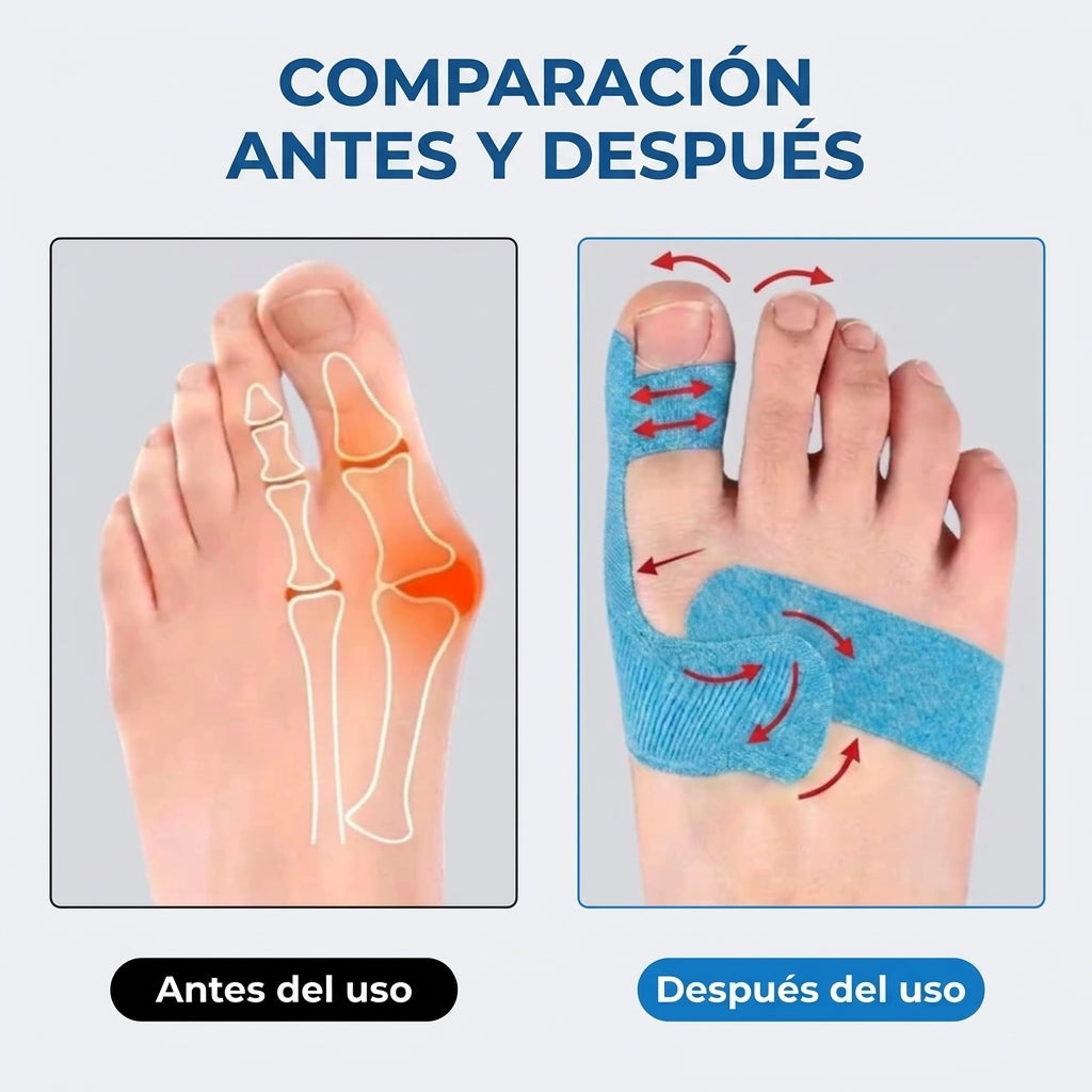 OrthoFlex - Cinta para el hallux valgus