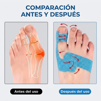 OrthoFlex - Cinta para el hallux valgus