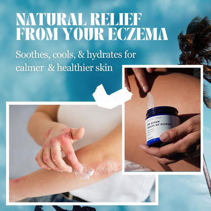 Crema calmante natural con musgo marino y avena - Alivio del eccema y la psoriasis - Minerales oceánicos - Para piel sensible - Crema hidratante para el eccema y la piel seca