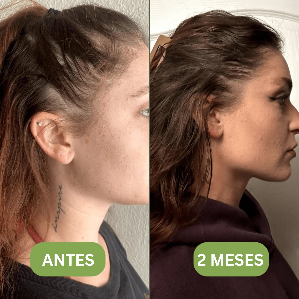 Aceite para el crecimiento del cabello (100% natural) - 1 + 1 GRATIS