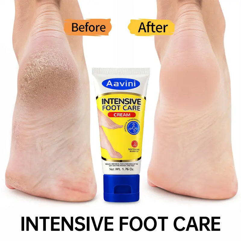 Crema Intensiva para Pies Talaporr: Repara la Piel Agrietada, Antibacteriana y Desodorante, Elimina y Suaviza las Callosidades, Para Todo Tipo de Piel, Loción Hidratante para Pies