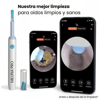 Limpiador de oídos inteligente con cámara HD