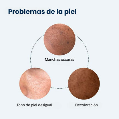REMEDY para manchas oscuras | Tratamiento todo en uno para corregir manchas oscuras