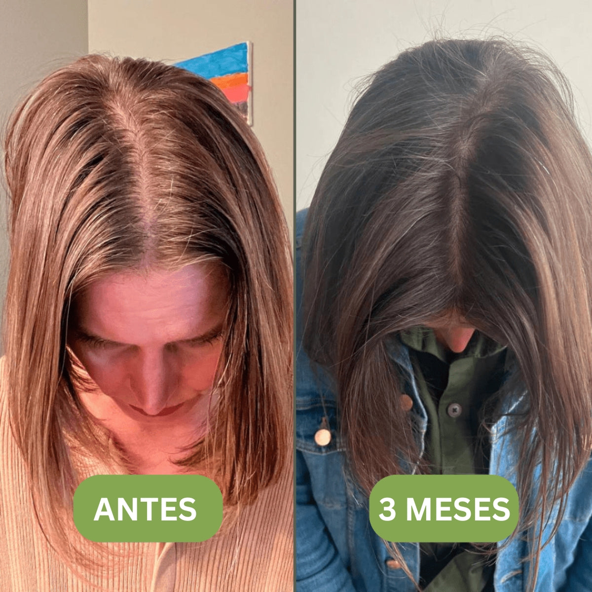 Aceite para el crecimiento del cabello (100% natural) - 1 + 1 GRATIS