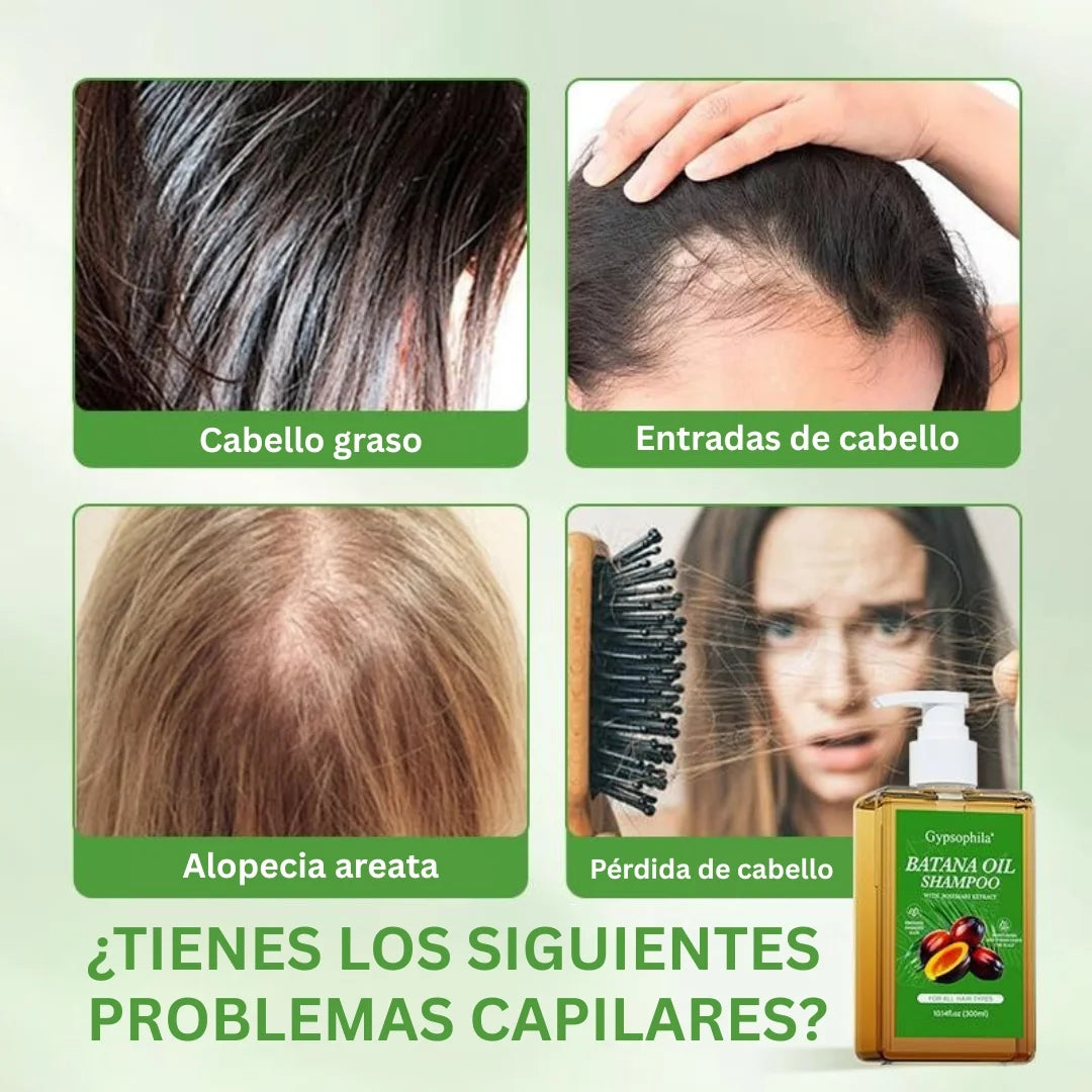 Champú con aceite de Gypsophila Batana y romero: champú nutritivo y voluminizador para hombres y mujeres. Limpia el cuero cabelludo, reduce la caída del cabello, repara el daño y favorece su crecimiento (300 ml/10,14 fl oz).