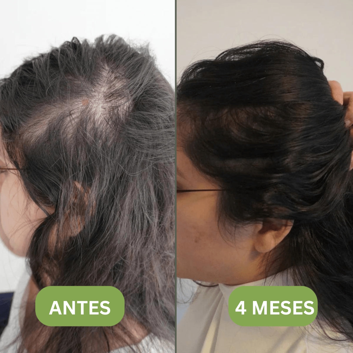 Aceite para el crecimiento del cabello (100% natural) - 1 + 1 GRATIS