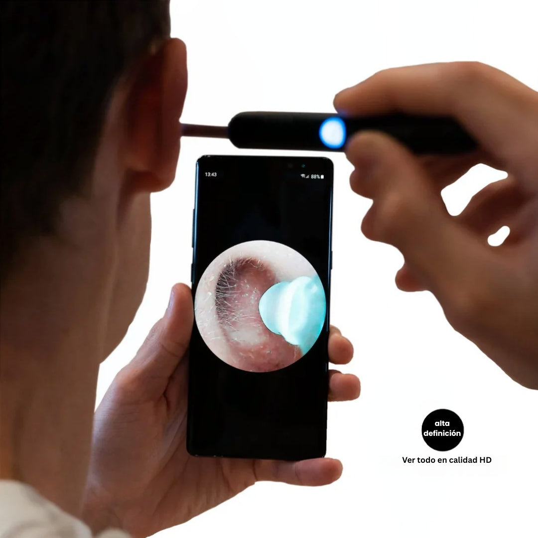 EarView™ – Limpieza inteligente de oídos con tecnología suave y avanzada