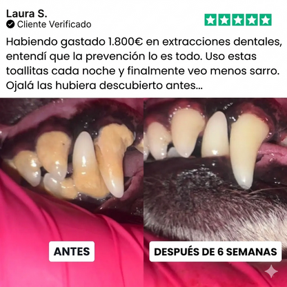 Toallitas dentales Talaporr™