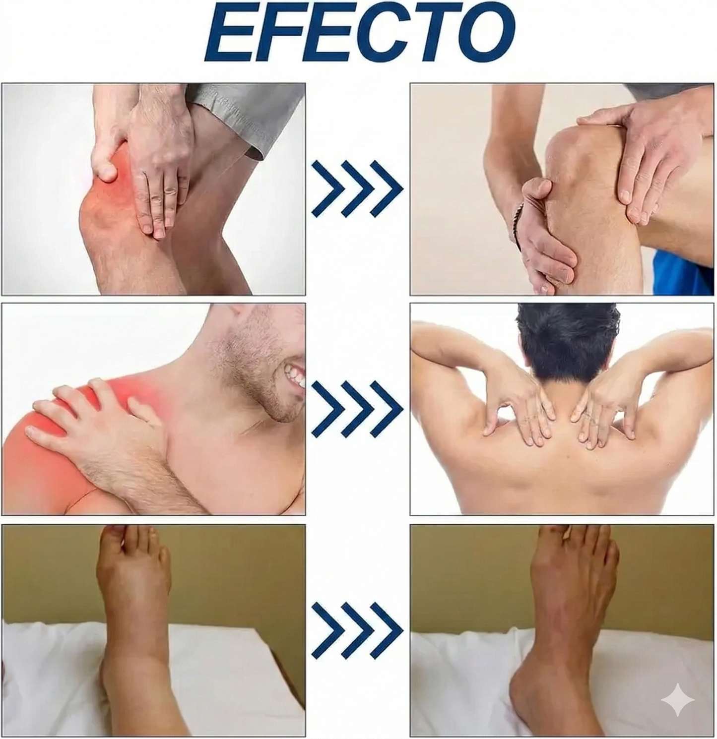 Crema para el alivio de la neuropatía - 100 g