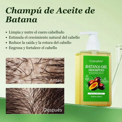 Champú con aceite de Gypsophila Batana y romero: champú nutritivo y voluminizador para hombres y mujeres. Limpia el cuero cabelludo, reduce la caída del cabello, repara el daño y favorece su crecimiento (300 ml/10,14 fl oz).