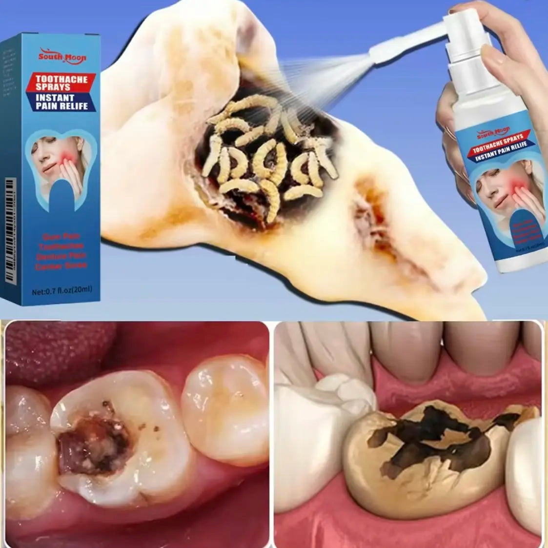 Alivio Del Dolor Spray Analgésico Dental Antiinflamatorio