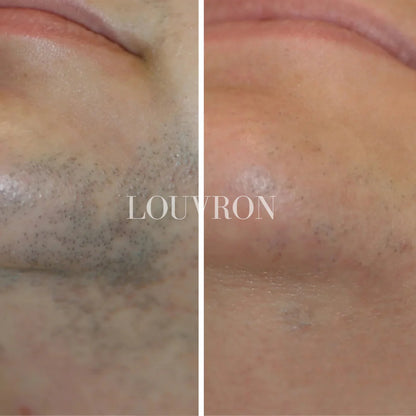 CyperPhase™ Cyperus Rotundus