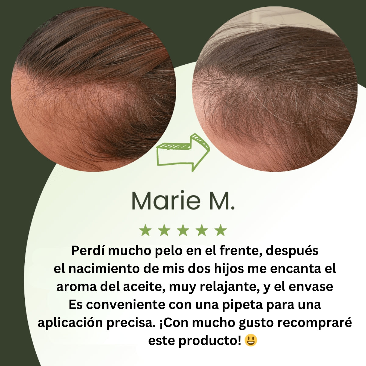 Aceite para el crecimiento del cabello (100% natural) - 1 + 1 GRATIS