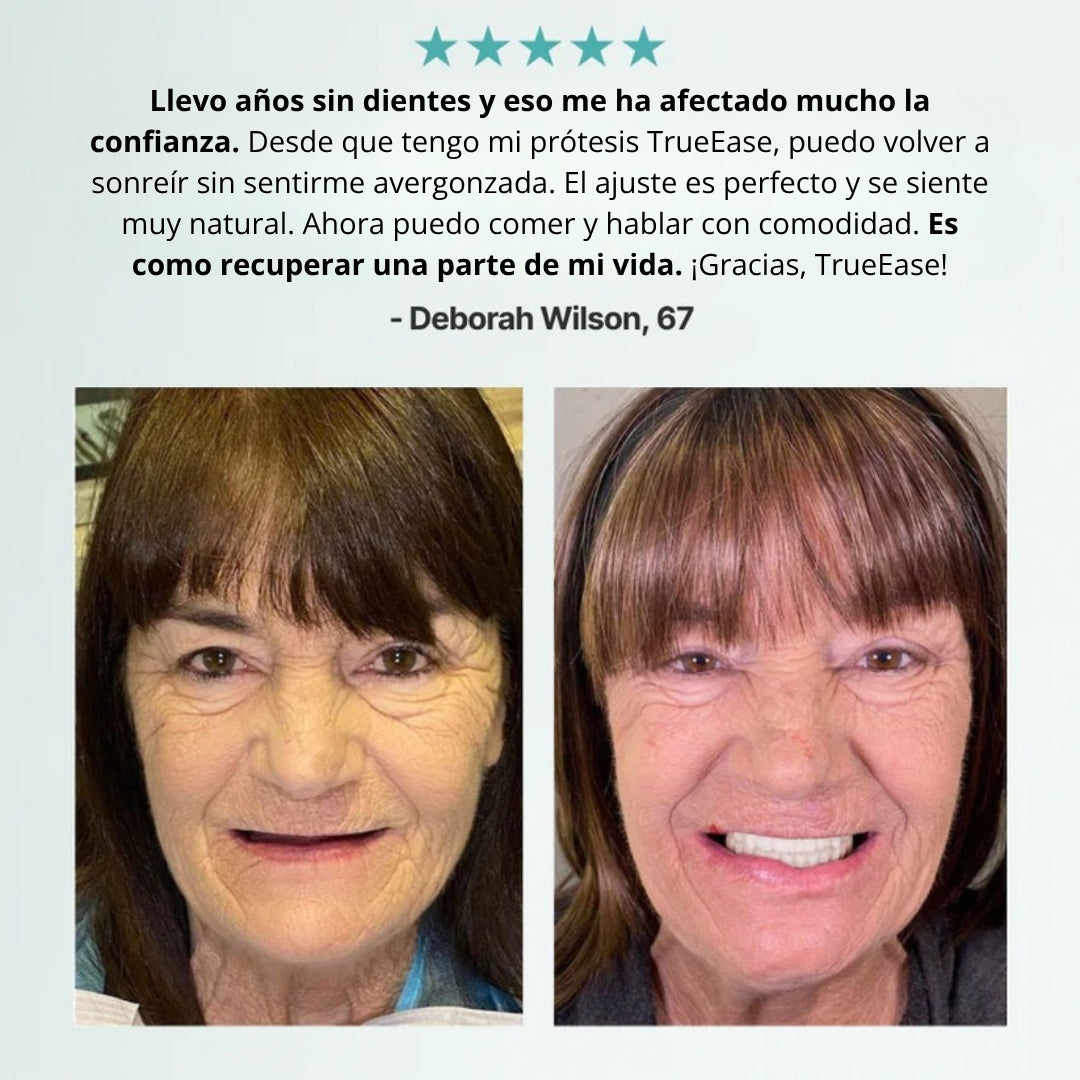 Prótesis dentales totalmente funcionales y personalizadas TrueEase™