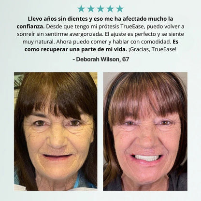 Prótesis dentales totalmente funcionales y personalizadas TrueEase™