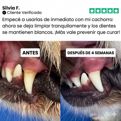 Toallitas dentales Talaporr™