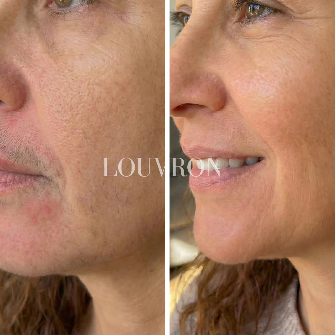 CyperPhase™ Cyperus Rotundus