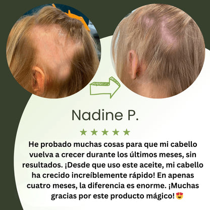 Aceite para el crecimiento del cabello (100% natural) - 1 + 1 GRATIS