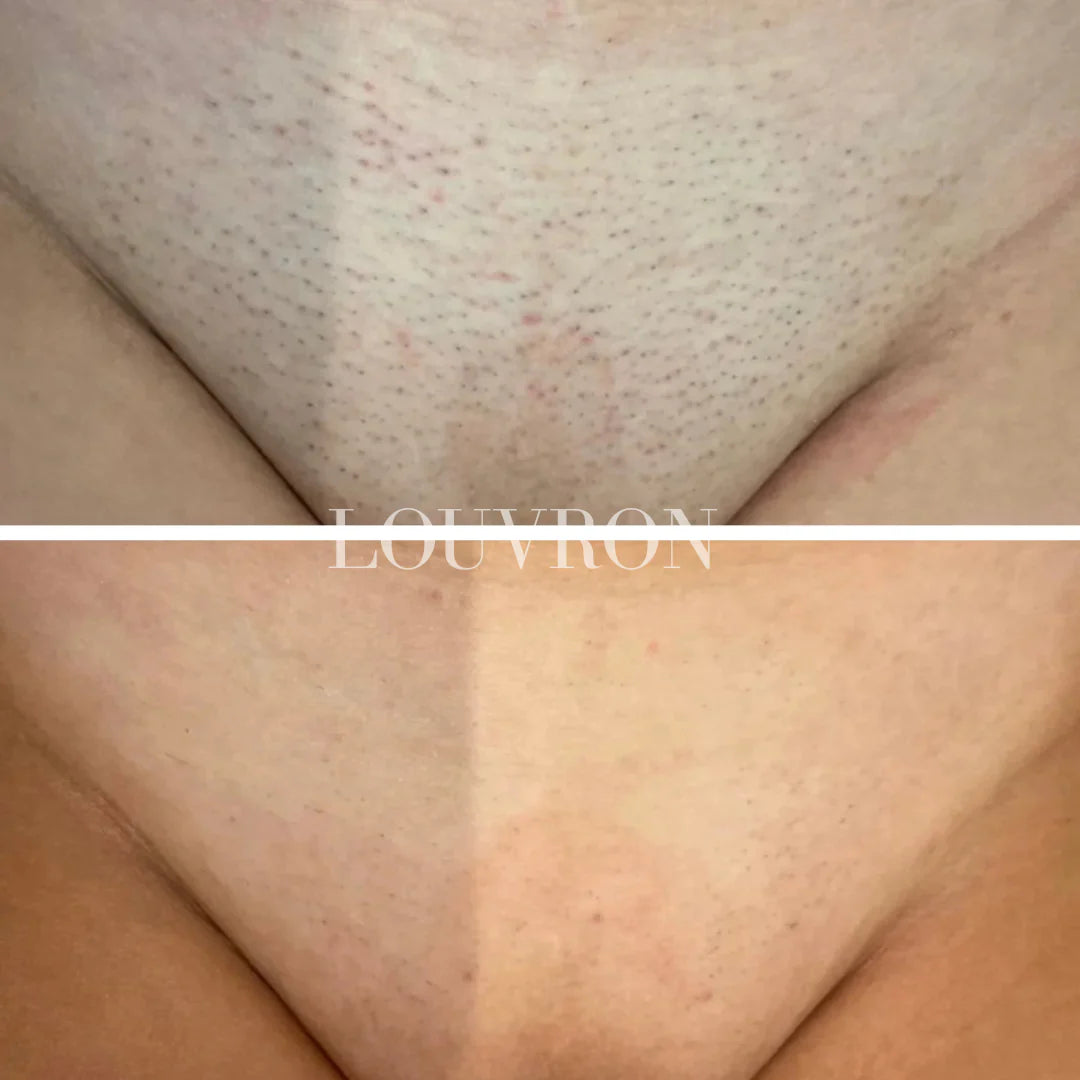 CyperPhase™ Cyperus Rotundus