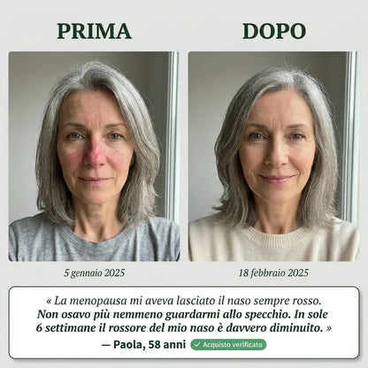 Sérum antienrojecimiento Talaporr