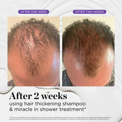 Dr. Groot Hair & Scalp Dynamic Duo Set Acondicionador Cuidado del Cabello Champú de Keratina para un Cabello Más Grueso, Biotina