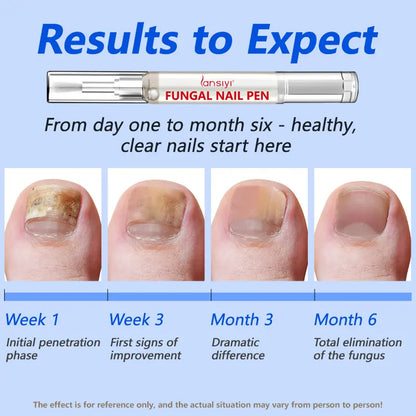 Lápiz para hongos en las uñas Lansiyi con alicina y ácido undecilénico, lápiz para el cuidado de las uñas, lápiz para el tratamiento de hongos en las uñas y otros problemas de uñas, kit de cuidado diario de uñas, suministros para manicuristas