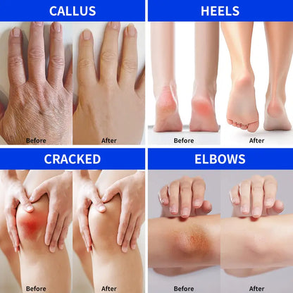 Crema Intensiva para Pies Talaporr: Repara la Piel Agrietada, Antibacteriana y Desodorante, Elimina y Suaviza las Callosidades, Para Todo Tipo de Piel, Loción Hidratante para Pies