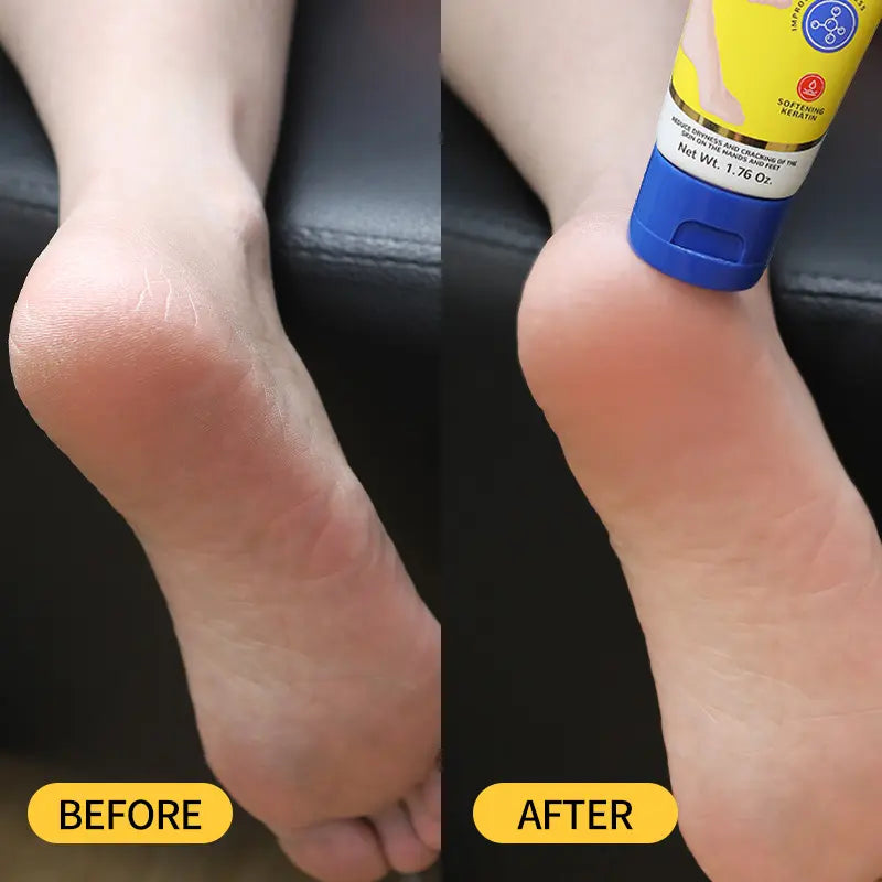Crema Intensiva para Pies Talaporr: Repara la Piel Agrietada, Antibacteriana y Desodorante, Elimina y Suaviza las Callosidades, Para Todo Tipo de Piel, Loción Hidratante para Pies