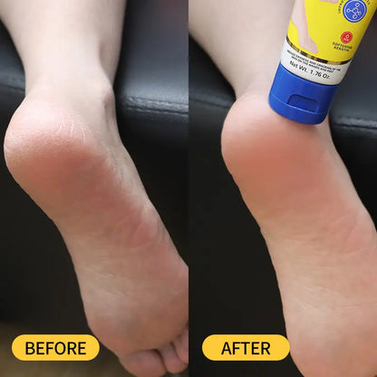 Crema Intensiva para Pies Talaporr: Repara la Piel Agrietada, Antibacteriana y Desodorante, Elimina y Suaviza las Callosidades, Para Todo Tipo de Piel, Loción Hidratante para Pies