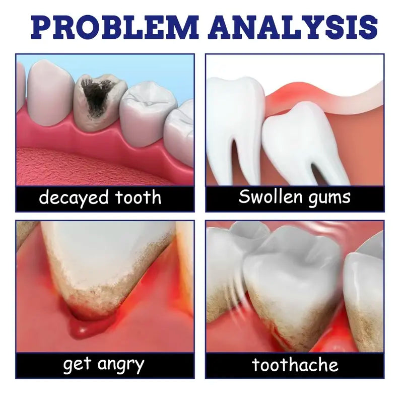 Alivio Del Dolor Spray Analgésico Dental Antiinflamatorio