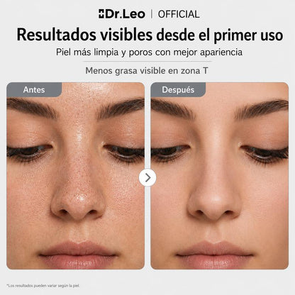 Limpieza Profunda Stick de Arcilla Volcánica con Carbón Activado